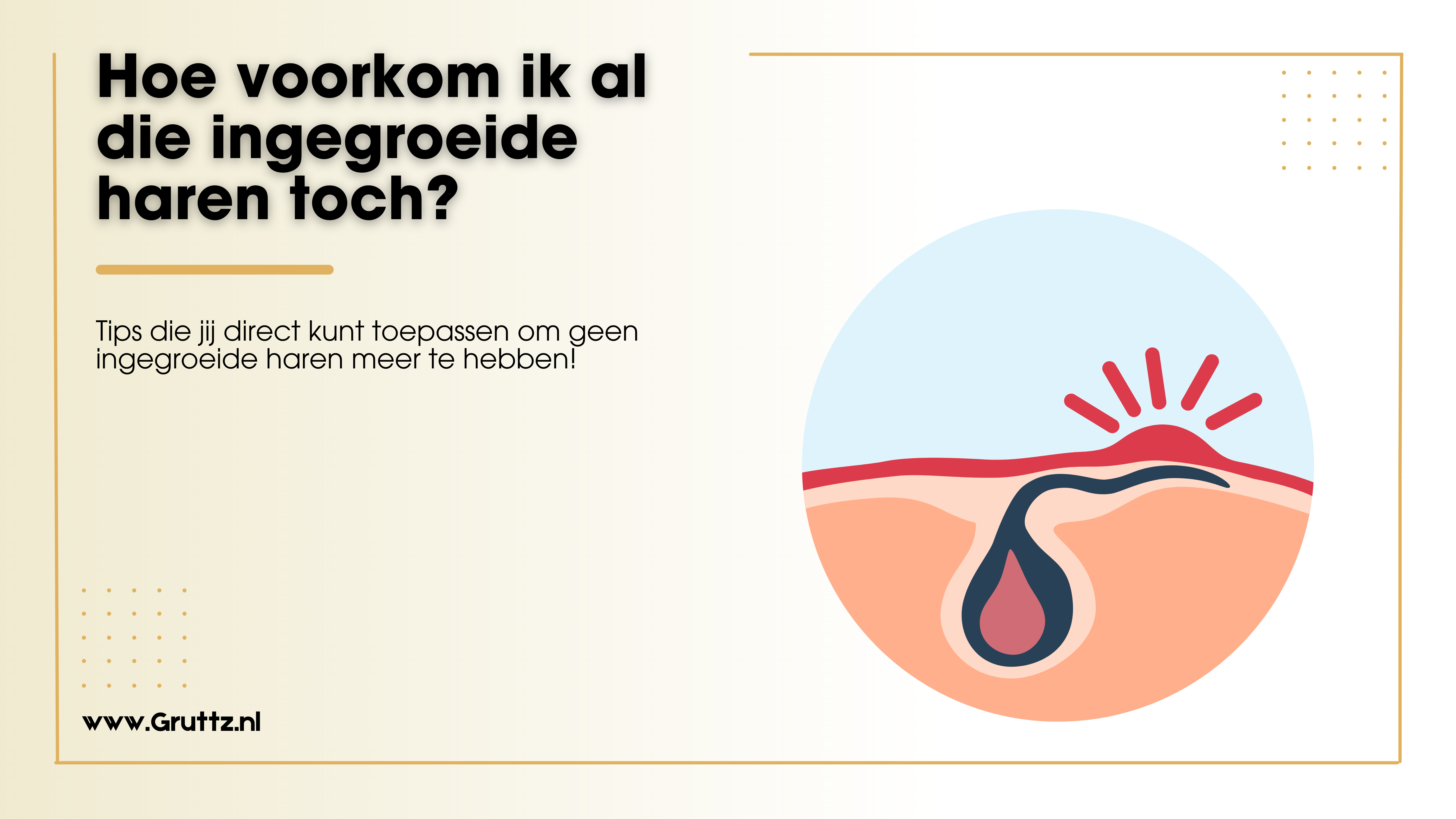Hoe Voorkom ik Ingegroeide Haren? Gruttz